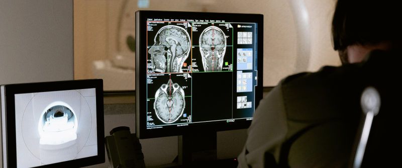 radiographer looks at cross sectional MRI images of a human skull