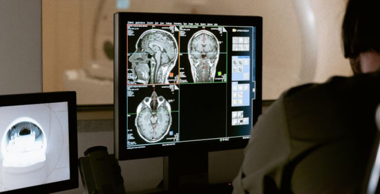 radiographer looks at cross sectional MRI images of a human skull