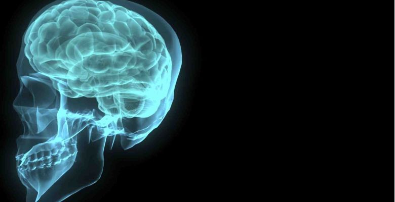 brain scan