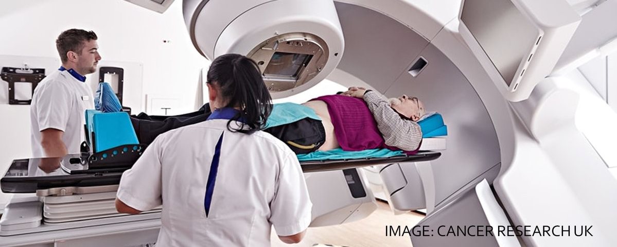 Treating the prostate with radiotherapy improves cancer survival