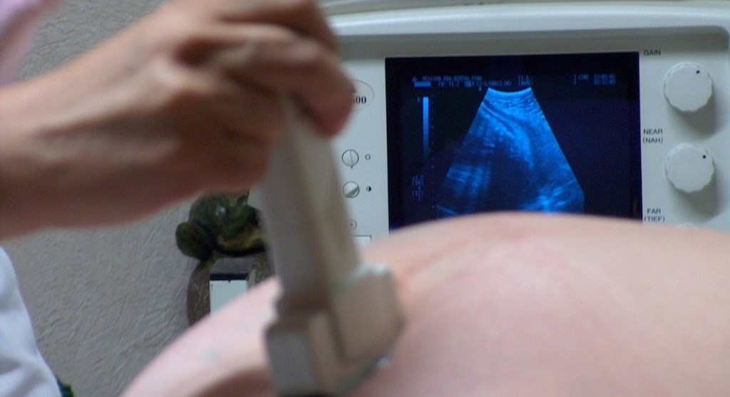 a pregnant woman has her ultrasound examination