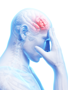 Illustration of brain during stroke