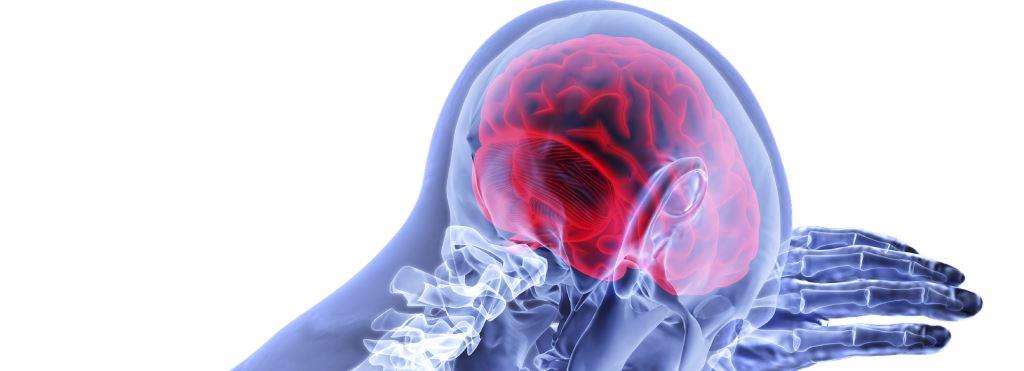 Traumatic brain injuries can increase risk of stroke for up to five years