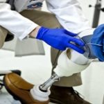 clinician assessing a patient's prosthetic leg