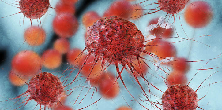 Immunotherapy hope for rare abdominal cancer