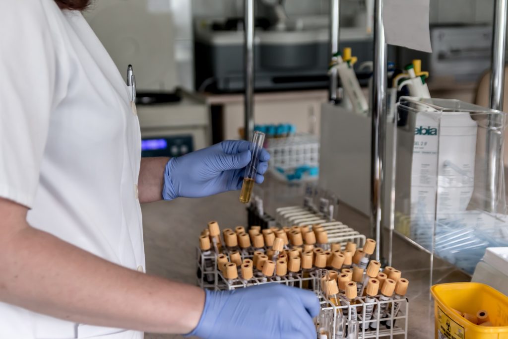 urine tests in laboratory