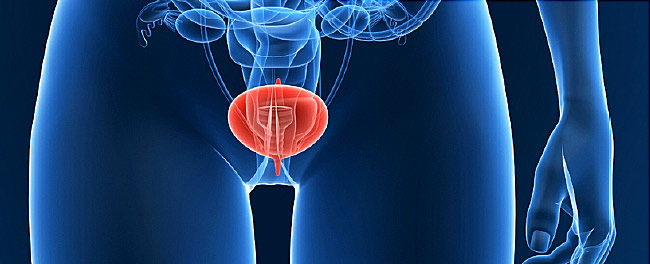 Urine test for bladder cancer to be developed by University of Birmingham and Nonacus