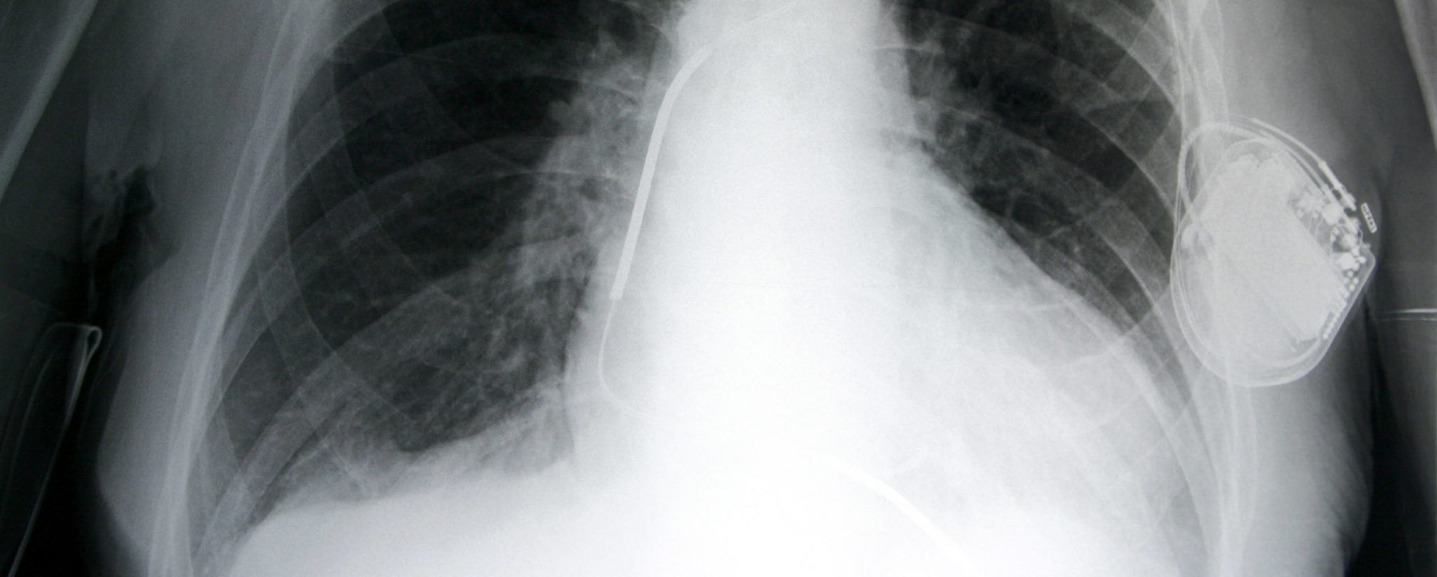 Birmingham Health Partners plays key role in report calling for