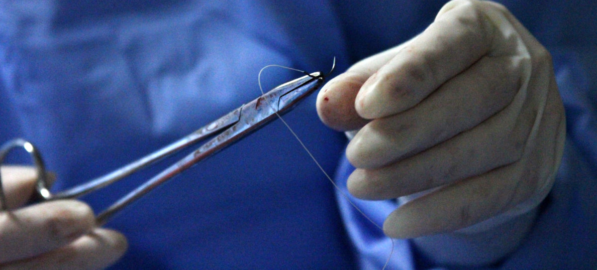 Single-stranded suture threads could prevent pregnancy infection complications, finds C-STICH trial
